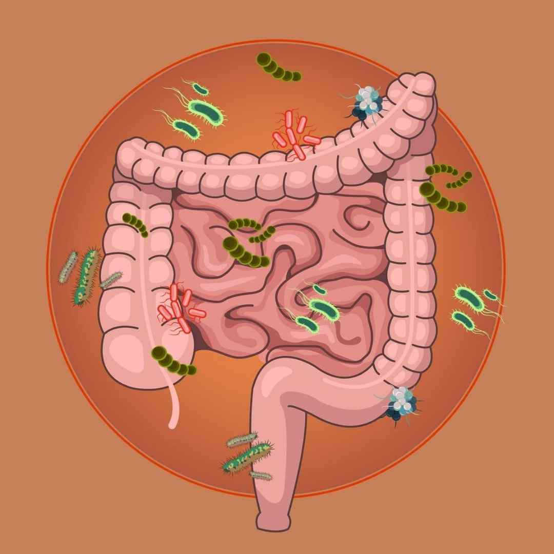 Curso SIBO para profesionales sanitarios (Actualización 2024)